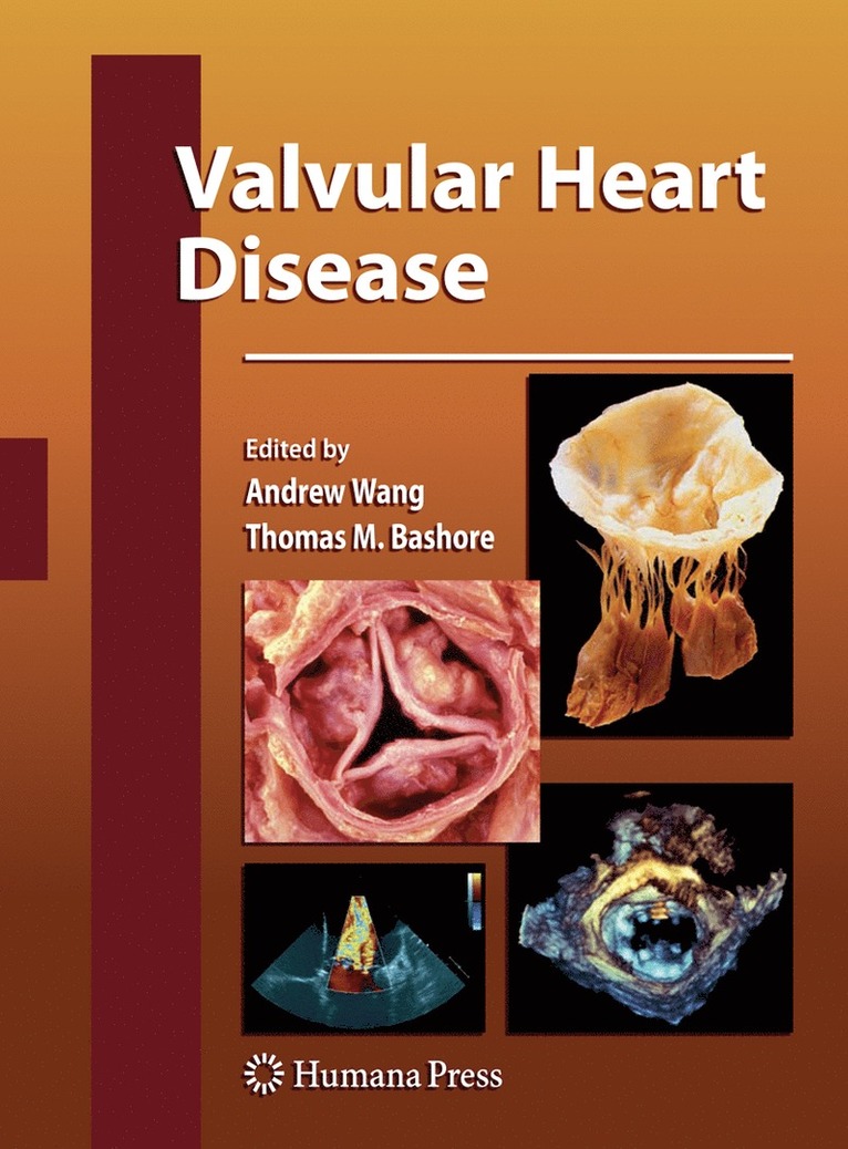 Andrew Wang, Thomas M. Bashore - Valvular Heart Disease, Inbunden