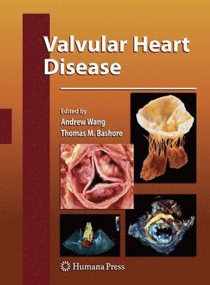 Valvular Heart Disease 1