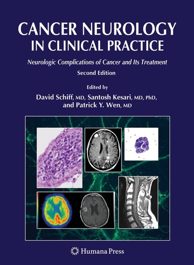 David Schiff, Santosh Kesari, Patrick C. Y. Wen - Cancer Neurology in Clinical Practice, Inbunden