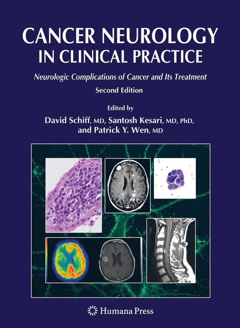 Cancer Neurology in Clinical Practice 1