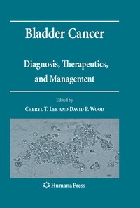 bokomslag Bladder Cancer