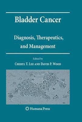 Bladder Cancer 1