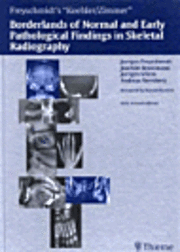 bokomslag Koehler/Zimmer Borderlands of Normal and Early Pathological Findings in Skeletal Radiography