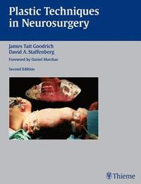 bokomslag Plastic Techniques in Neurosurgery