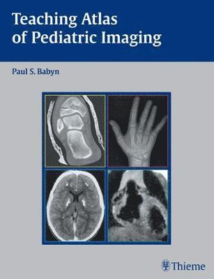 bokomslag Teaching Atlas of Pediatric Imaging