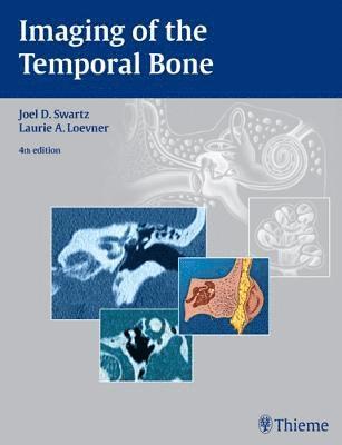 bokomslag Imaging of the Temporal Bone