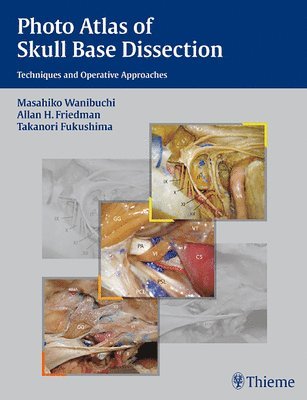 Photo Atlas of Skull Base Dissection: Techniques and Operative Approaches 1