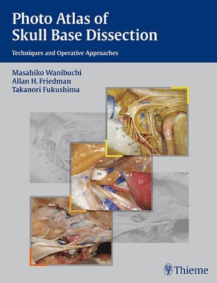 Wanibuchi, M: Photo Atlas of Skull Base Dissection