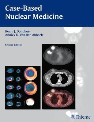 Case-Based Nuclear Medicine 1