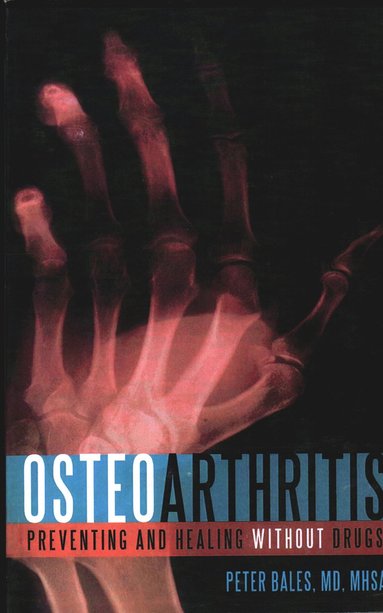 bokomslag Osteoarthritis