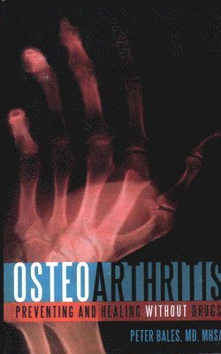 Osteoarthritis 1