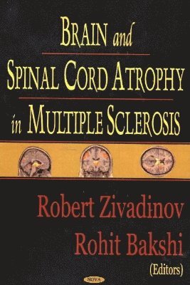 bokomslag Brain & Spinal Cord Atrophy in Multiple Sclerosis