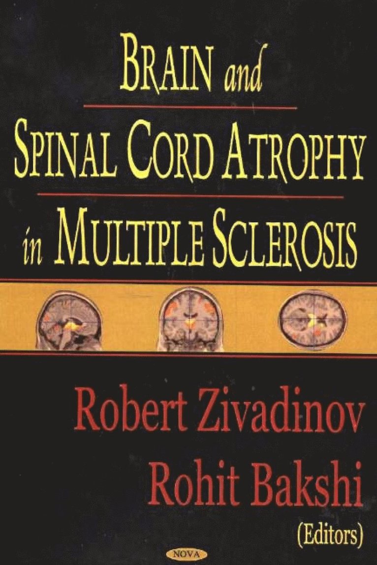 Robert Zivadinov, Rophit Bakshi - Brain & Spinal Cord Atrophy in Multiple Sclerosis, Inbunden