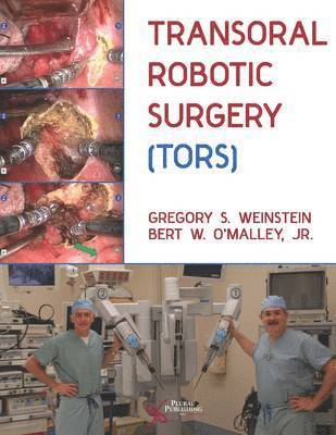 Gregory S. Weinstein, Bert W. O'Malley, Gregory S Weinstein - Transoral Robotic Surgery (TORS), Inbunden