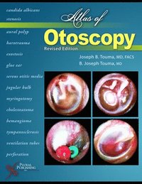 bokomslag Atlas of Otoscopy