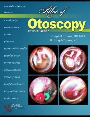 Atlas of Otoscopy 1