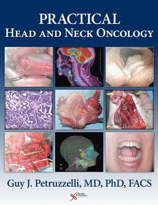 bokomslag Practical Head and Neck Oncology