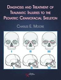 bokomslag Diagnosis and Treatment of Traumatic Injuries to the Pediatric Craniofacial Skeleton