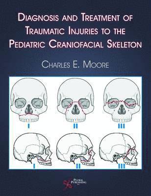 Diagnosis and Treatment of Traumatic Injuries to the Pediatric Craniofacial Skeleton 1