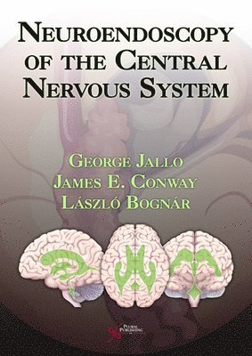 Neuroendoscopy of the Central Nervous System 1
