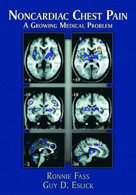 bokomslag Noncardiac Chest Pain