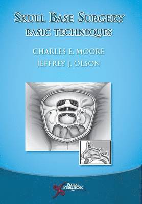 bokomslag Skull Base Surgery
