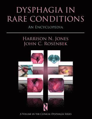 Harrison N. Jones, John C. Rosenbek, Harrison N Jones, John C Rosenbek - Dysphagia in Rare Conditions, Inbunden