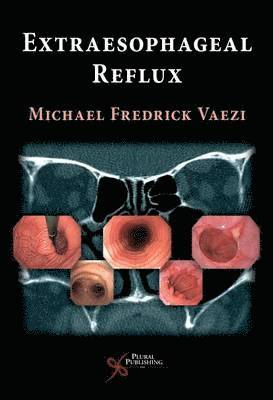 Michael F. Vaezi, TBD - Extra Esophageal Reflux, Inbunden