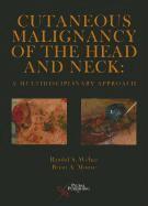 Randal S. Weber, Brian A. Moore - Cutaneous Malignancy of the Head and Neck, Inbunden