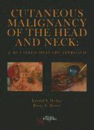 Cutaneous Malignancy of the Head and Neck 1