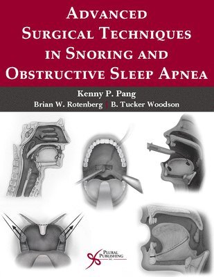bokomslag Advanced Surgical Techniques in Snoring and Obstructive Sleep Apnea