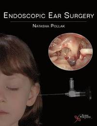 bokomslag Endoscopic Ear Surgery
