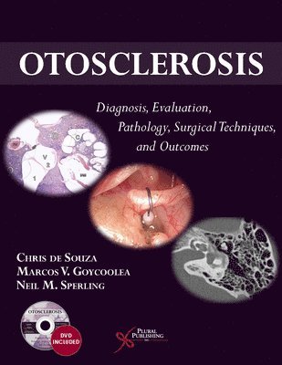 Otosclerosis 1