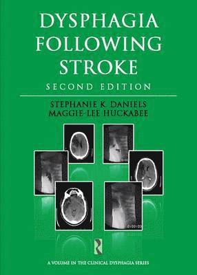 Dysphagia Following Stroke 1