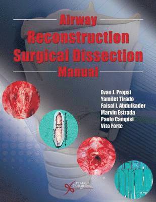 Evan J. Propst, Yamilet Tirado, Faisal I. Abdulkader, Evan J Propst - Airway Reconstruction Surgical Dissection Manual, Häftad