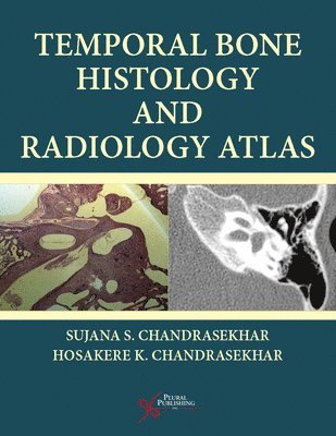 bokomslag Temporal Bone Histology and Radiology Atlas