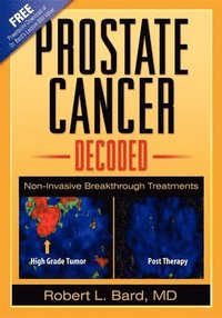 bokomslag Prostate Cancer Decoded