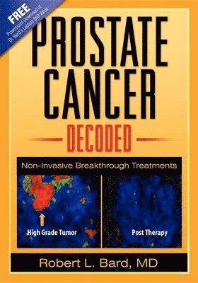 Prostate Cancer Decoded 1