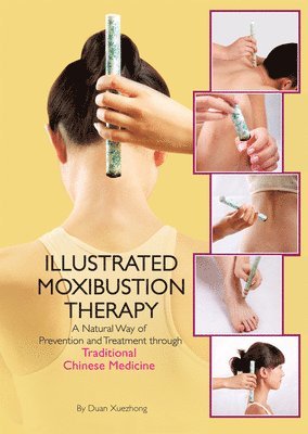 The Illustrated Moxibustion Therapy 1