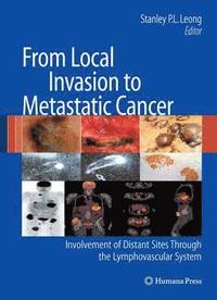 bokomslag From Local Invasion to Metastatic Cancer