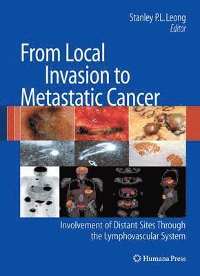 From Local Invasion to Metastatic Cancer 1