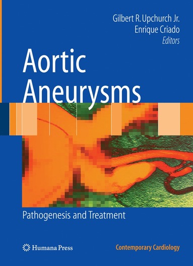 bokomslag Aortic Aneurysms