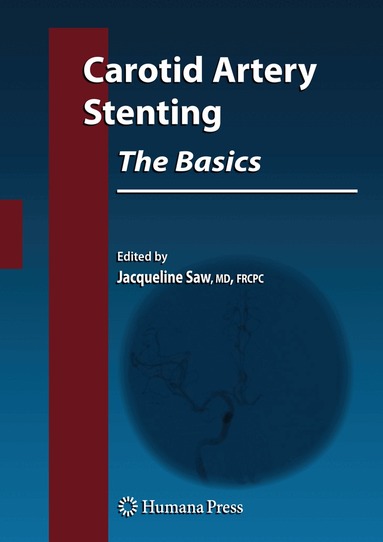 Jacqueline Saw - Carotid Artery Stenting: The Basics, Inbunden