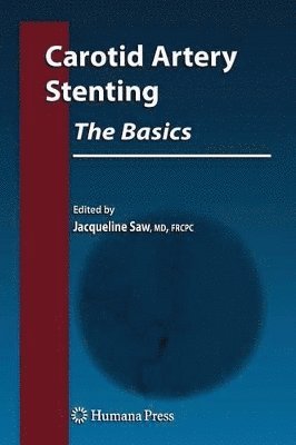 bokomslag Carotid Artery Stenting: The Basics