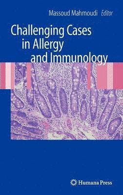 bokomslag Challenging Cases in Allergy and Immunology