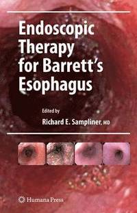 bokomslag Endoscopic Therapy for Barrett's Esophagus