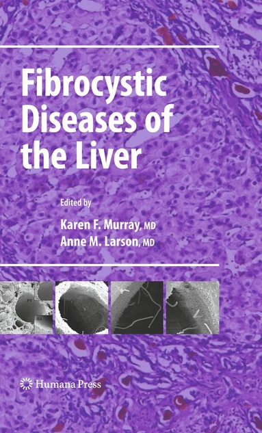 bokomslag Fibrocystic Diseases of the Liver