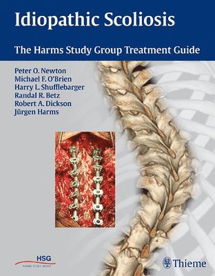 bokomslag Idiopathic Scoliosis: The Harms Study Group Treatment Guide