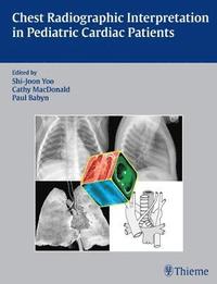 bokomslag Chest Radiographic Interpretation in Pediatric Cardiac Patients