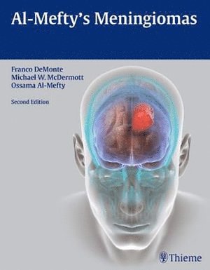 Franco DeMonte, Michael W. McDermott, Ossama Al-Mefty, Franco Demonte, Michael W McDermott - Al-Mefty's Meningiomas, Inbunden